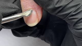 Hvordan laver man rigtig prep af negle